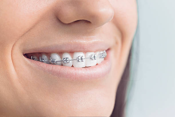 Best Teeth Whitening  in Germantown, WI